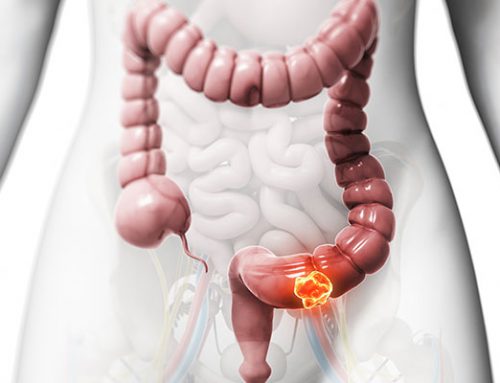 Postbiotic: Butyrate Promote Colon Cancer Cell Death